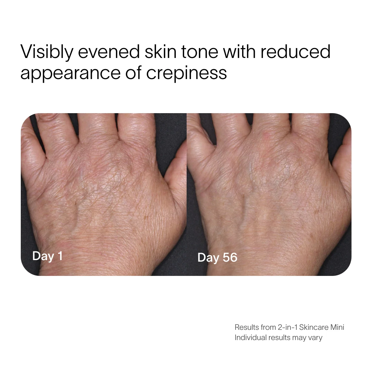 Radiant Renewal 2-in-1 Skincare Mini - Image 9