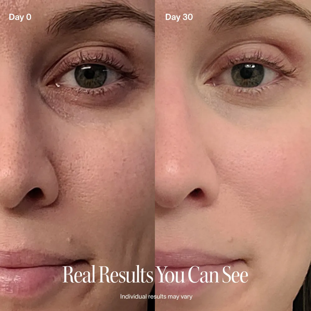 4-in-1 Radiant Renewal Skincare Wand with Red Light Therapy - Image 36